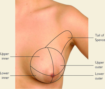 Breast Tissue Migration: Fact or Fiction? - Lingerie Briefs ~ by Ellen Lewis