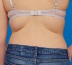 Breast Tissue Migration: Fact or Fiction? - Lingerie Briefs ~ by Ellen Lewis