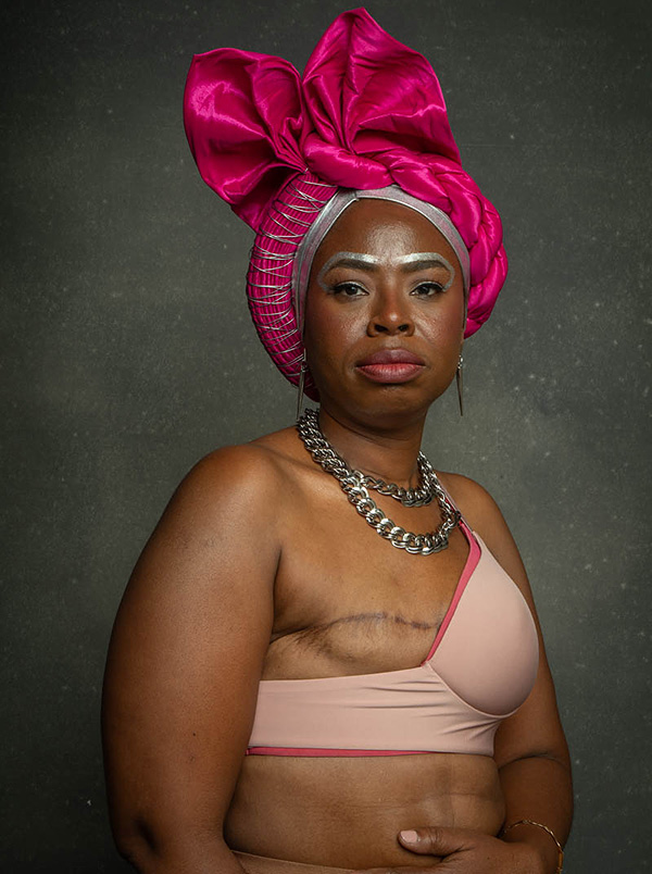The Beyond Pink Project photographed by Becky Yee captures AnaOno products for mastectomy, implants, flap surgery and more as featured on Lingerie Briefs